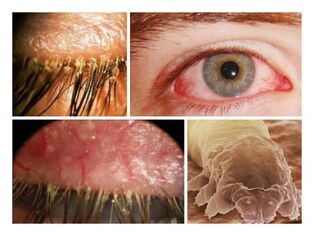人体皮肤下存在寄生虫的症状