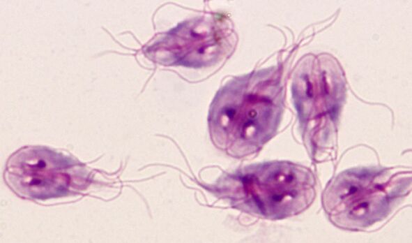 人体中最简单的兰伯氏菌寄生虫