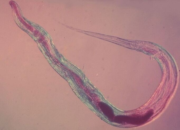 显微镜下的蛲虫